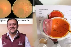 UPT desarrolla tecnología de bajo costo para detectar enfermedades que causan ceguera